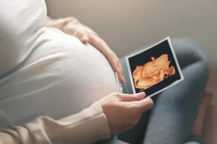 3D_4D Ultrasound-